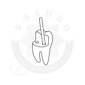 Пост-ендодонтичне відновлення твердих тканин зуба Пост-ендодонтичне відновлення твердих тканин зуба