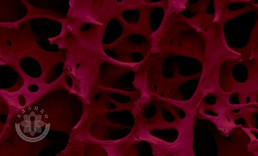 Встречайте BONTREE® в Бланко